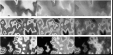 Journal of Tissue Repair and Regeneration-cellulite