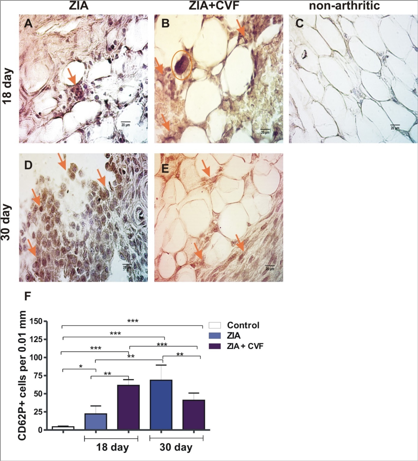 megakaryocytes