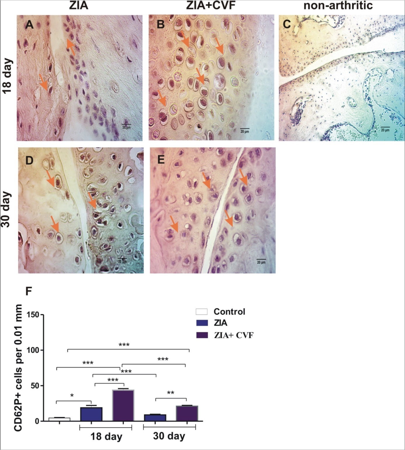 megakaryocytes