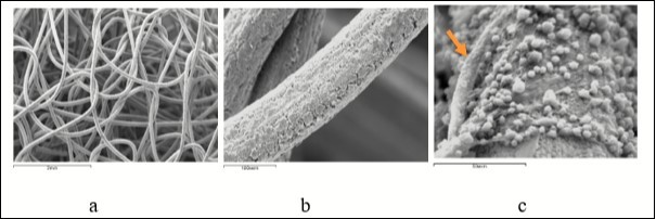 reparative osteogenesis