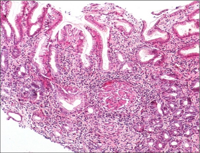 Journal of Spleen And Liver Research-hematoxylin
