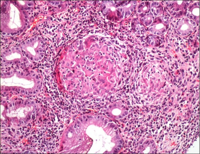 Journal of Spleen And Liver Research-hematoxylin