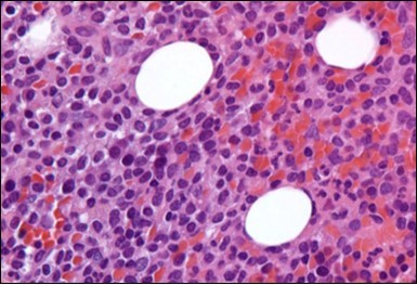 Journal of Clinical and Diagnostic Pathology-Leukaemia