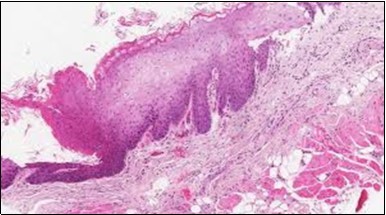Journal of Clinical and Diagnostic Pathology-Leukaemia