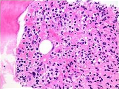 Journal of Clinical and Diagnostic Pathology-Leukaemia