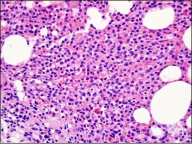 Journal of Clinical and Diagnostic Pathology-Leukaemia