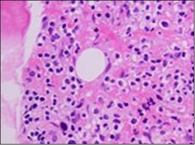 Journal of Clinical and Diagnostic Pathology-Leukaemia