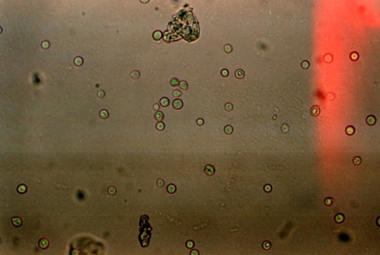 Amphotericin B