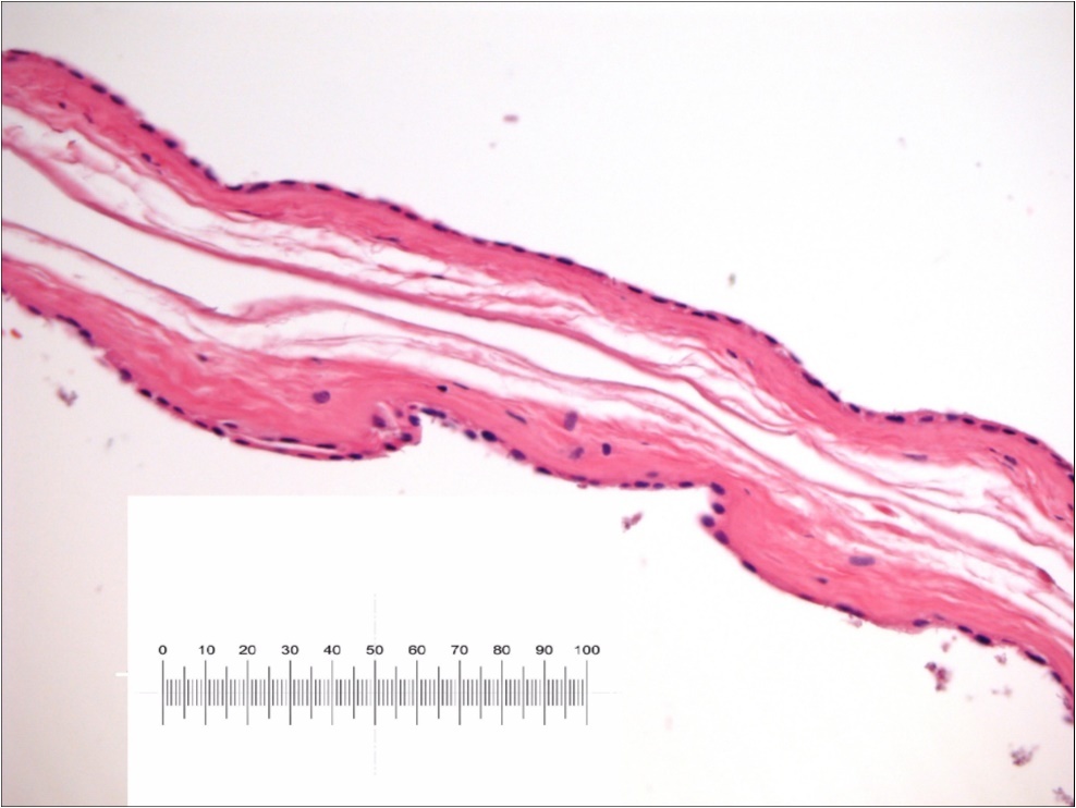 Toxic epidermal necrolysis