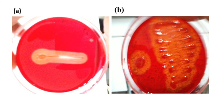 Cellulase