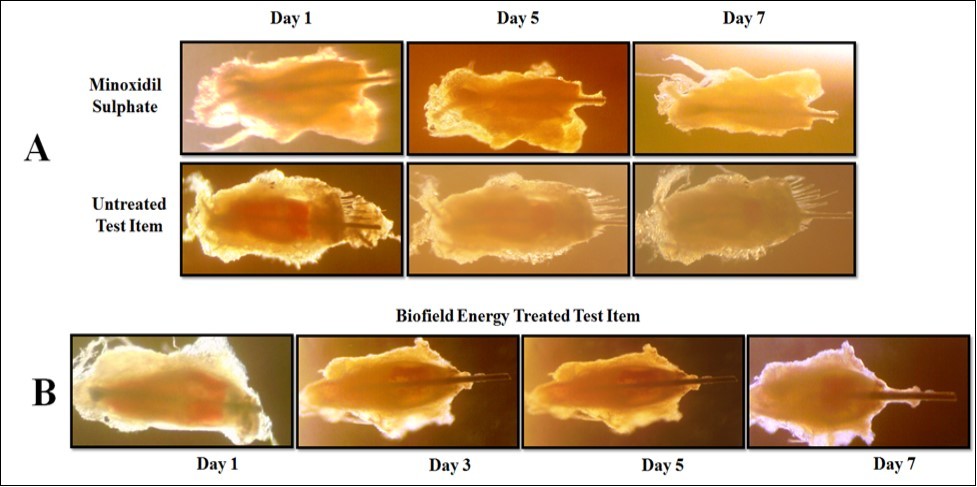 Journal of Dermatologic Research And Therapy-Hair growth