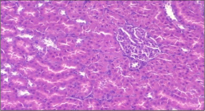 Journal of Obesity Management-Fennel -Foeniculum vulgare- Atorvastatin- obesity- histopathology-rats-herb