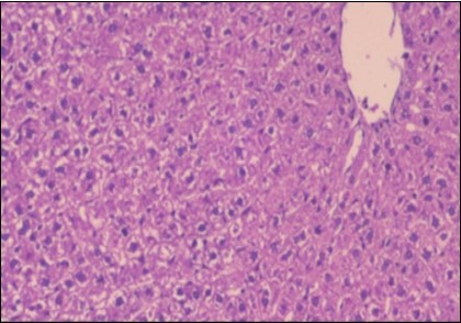 Journal of Obesity Management-Fennel -Foeniculum vulgare- Atorvastatin- obesity- histopathology-rats-herb