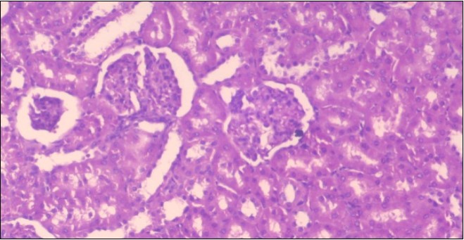 Journal of Obesity Management-Fennel -Foeniculum vulgare- Atorvastatin- obesity- histopathology-rats-herb