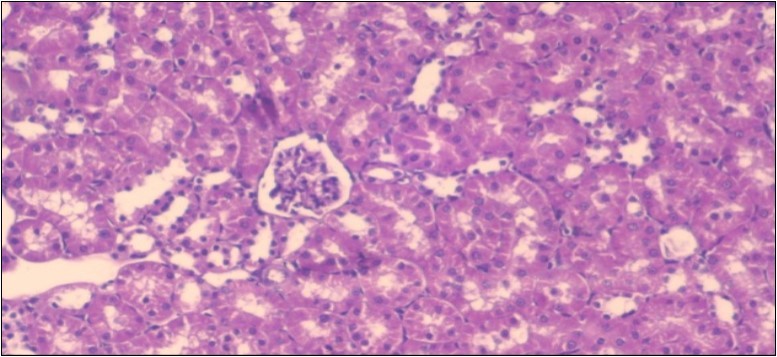 Journal of Obesity Management-Fennel -Foeniculum vulgare- Atorvastatin- obesity- histopathology-rats-herb