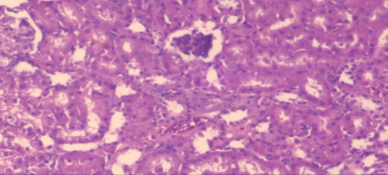 Journal of Obesity Management-Fennel -Foeniculum vulgare- Atorvastatin- obesity- histopathology-rats-herb