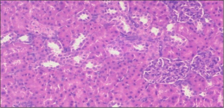 Journal of Obesity Management-Fennel -Foeniculum vulgare- Atorvastatin- obesity- histopathology-rats-herb