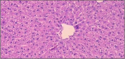 Journal of Obesity Management-Fennel -Foeniculum vulgare- Atorvastatin- obesity- histopathology-rats-herb