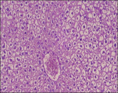 Journal of Obesity Management-Fennel -Foeniculum vulgare- Atorvastatin- obesity- histopathology-rats-herb