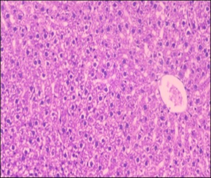 Journal of Obesity Management-Fennel -Foeniculum vulgare- Atorvastatin- obesity- histopathology-rats-herb