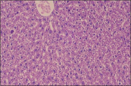 Journal of Obesity Management-Fennel -Foeniculum vulgare- Atorvastatin- obesity- histopathology-rats-herb