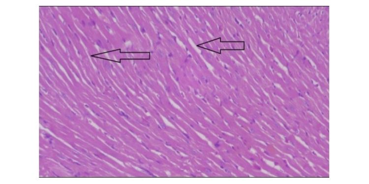 Article: Interaction Between Ator and Fennel in the Treatment of Obesity in Rats