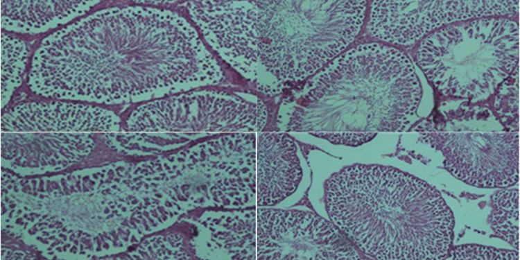 Article: Ozone/Oxygen Molecules Exert Mild Oxidative Stress on Testis Mitochondria Isolated from the Rat Testicular Ischemia/Reperfusion Injury 