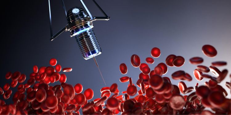 Article: Intravascular Laser Irradiation of Blood (ILIB) on Sleep Quality Improvement: A Randomized Placebo-Controlled Clinical Trial